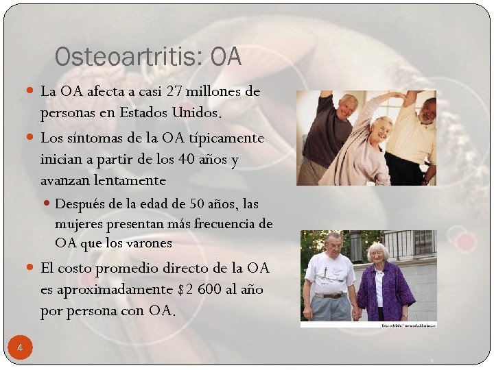 Osteoartritis: OA La OA afecta a casi 27 millones de personas en Estados Unidos.