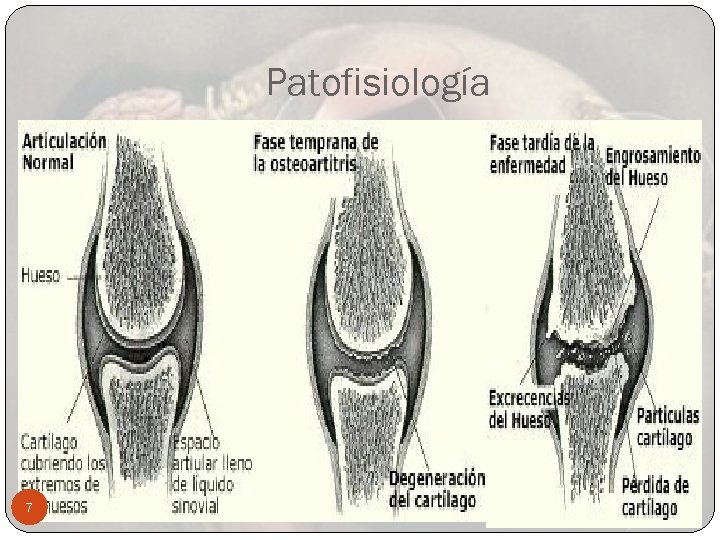 Patofisiología 7 
