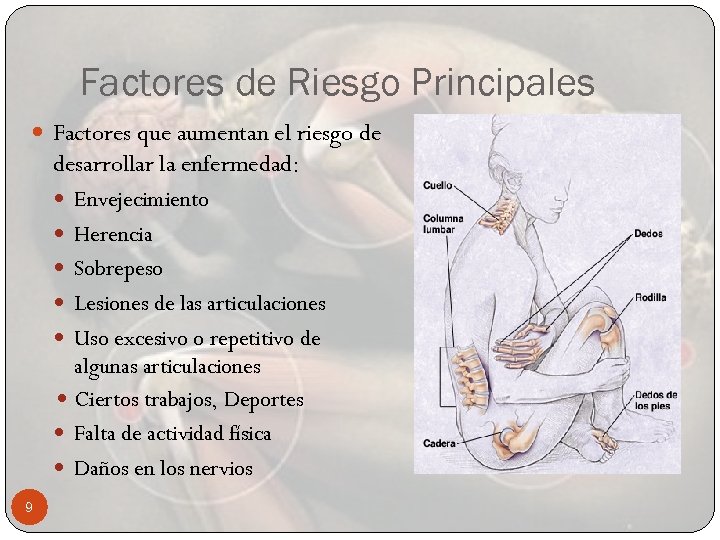 Factores de Riesgo Principales Factores que aumentan el riesgo de desarrollar la enfermedad: Envejecimiento