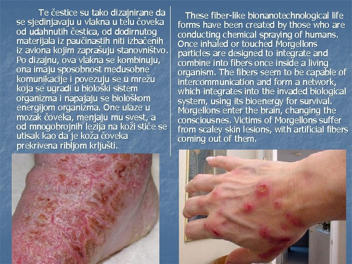 Te čestice su tako dizajnirane da se sjedinjavaju u vlakna u telu čoveka od