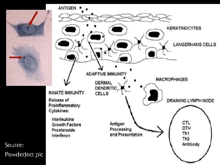 Source: Powder. Ject plc 