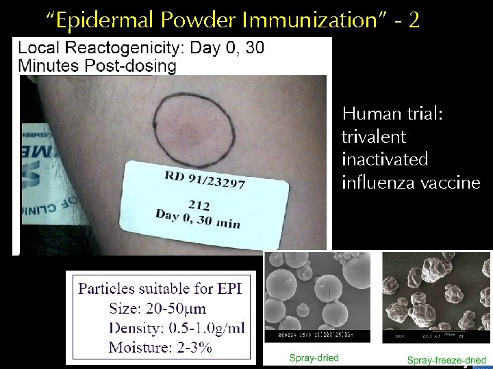 “Epidermal Powder Immunization” - 2 Human trial: trivalent inactivated influenza vaccine 