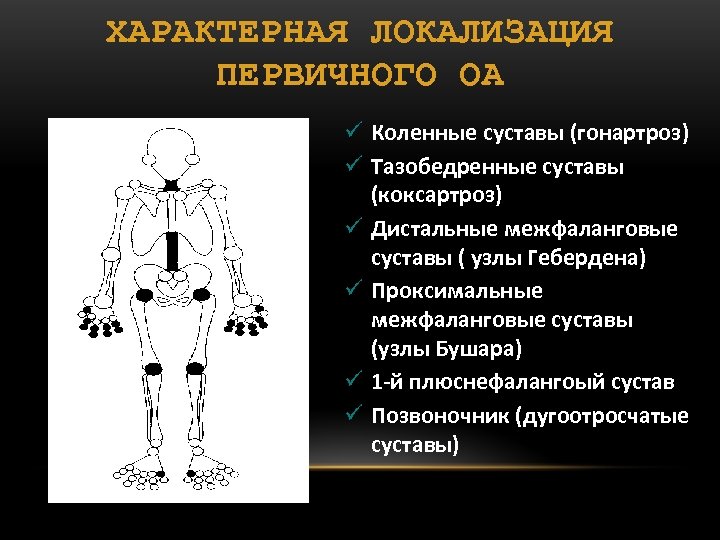 ХАРАКТЕРНАЯ ЛОКАЛИЗАЦИЯ ПЕРВИЧНОГО ОА ü Коленные суставы (гонартроз) ü Тазобедренные суставы (коксартроз) ü Дистальные