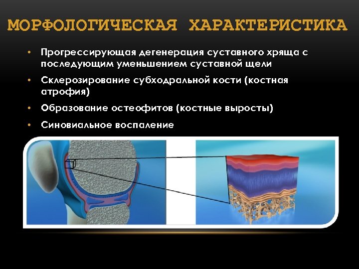 МОРФОЛОГИЧЕСКАЯ ХАРАКТЕРИСТИКА • Прогрессирующая дегенерация суставного хряща с последующим уменьшением суставной щели • Склерозирование
