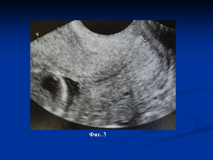 Фиг. 3 