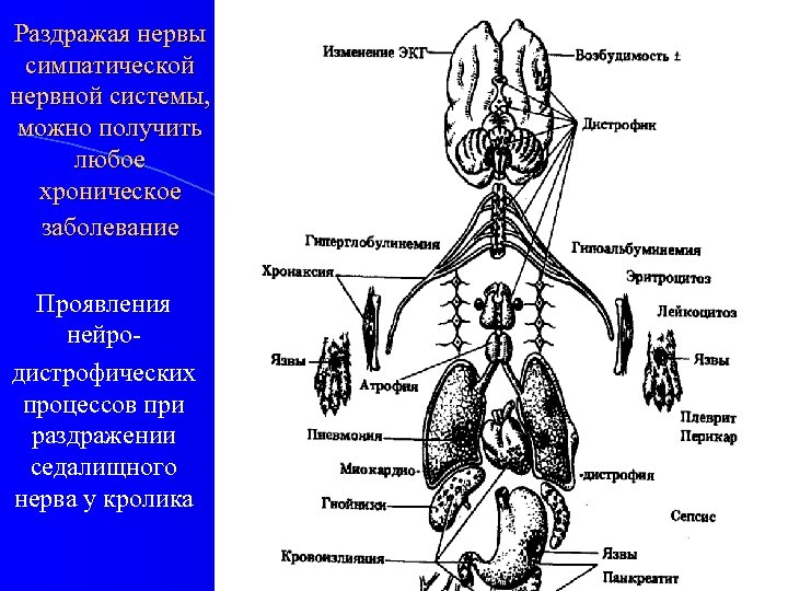 Раздражая нервы симпатической нервной системы, можно получить любое хроническое заболевание Проявления нейродистрофических процессов при