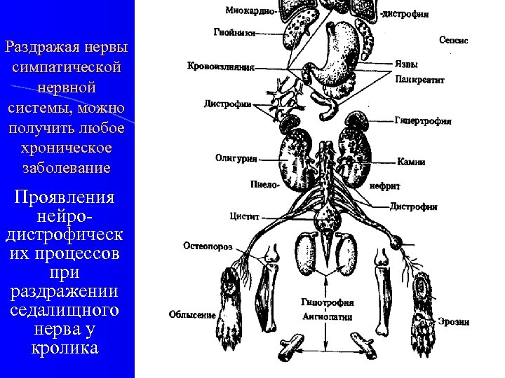 Раздражая нервы симпатической нервной системы, можно получить любое хроническое заболевание Проявления нейродистрофическ их процессов