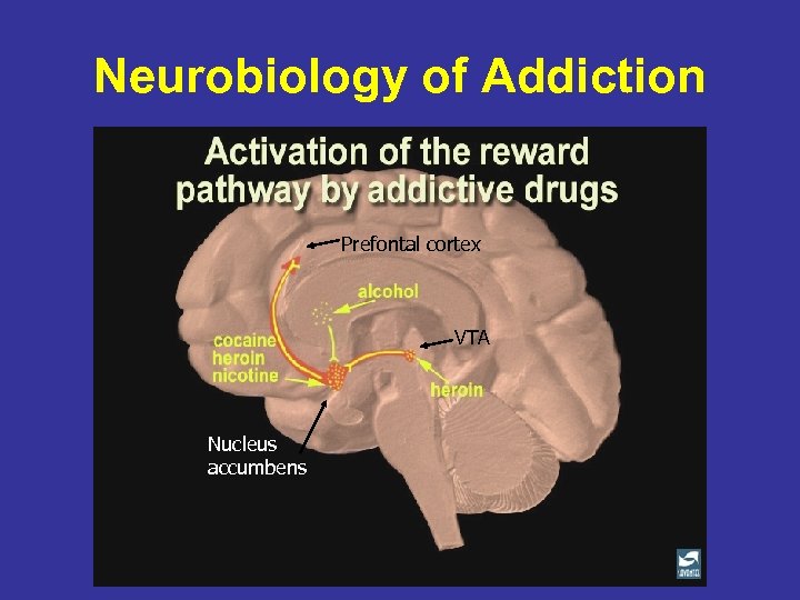 Neurobiology of Addiction Prefontal cortex VTA Nucleus accumbens 