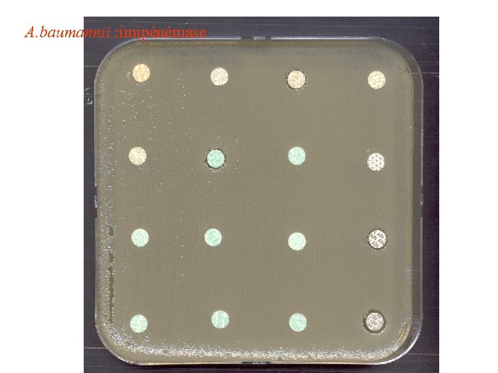 A. baumannii : imipénémase 