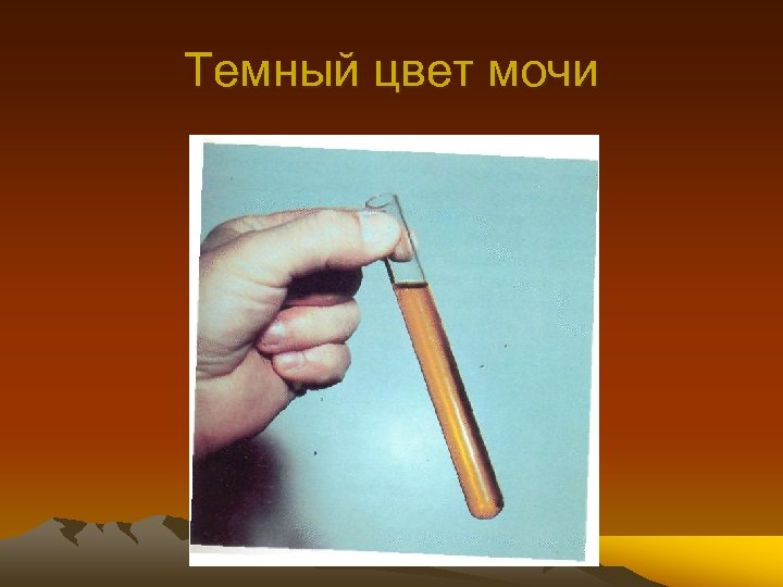 Темный цвет мочи 