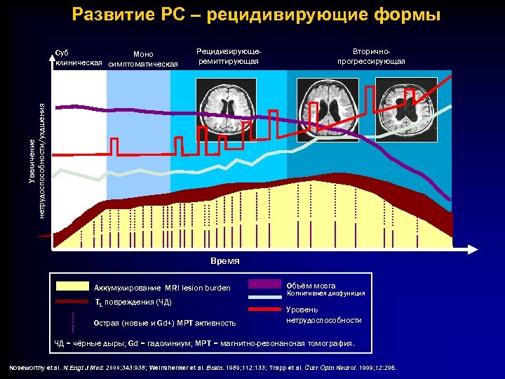Развитие РС – рецидивирующие формы Рецидивирующеремиттирующая Вторичнопрогрессирующая Увеличение нетрудоспособности/ухдшения Суб Моно клиническая симптоматическая Время