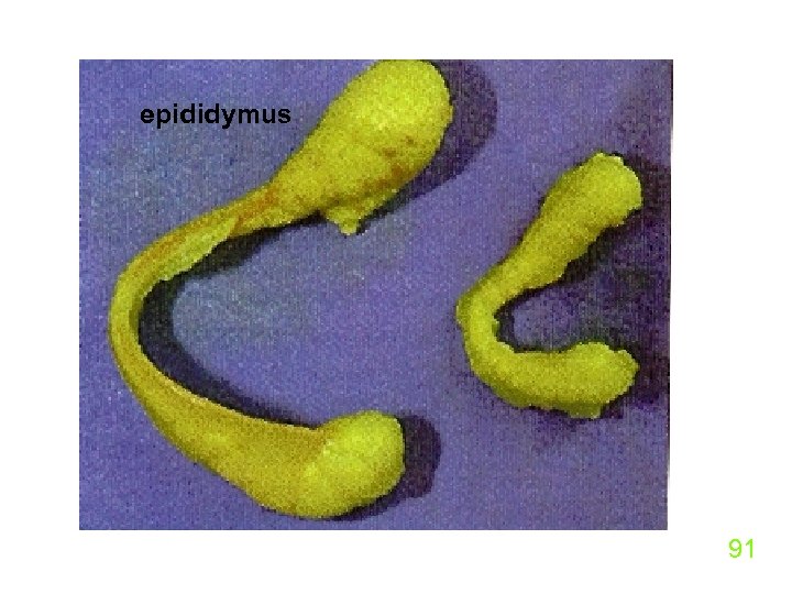 epididymus 91 