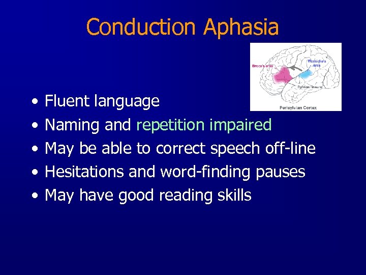 Conduction Aphasia • • • Fluent language Naming and repetition impaired May be able