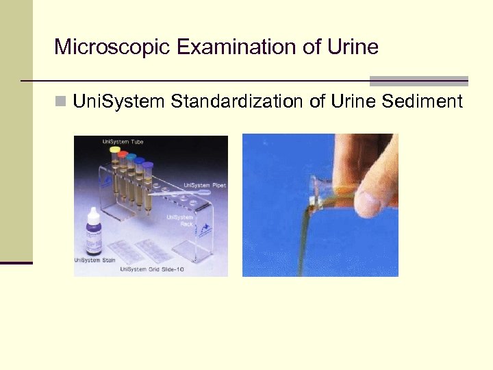 Microscopic Examination of Urine n Uni. System Standardization of Urine Sediment 