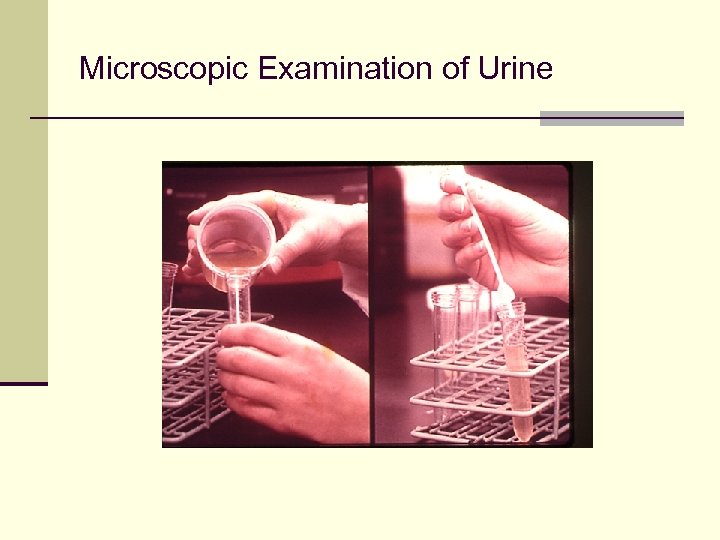 Microscopic Examination of Urine 