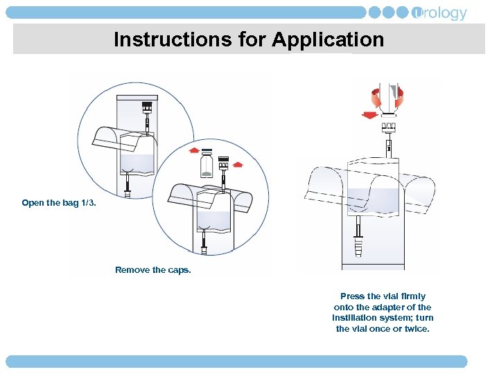 Instructions for Application Open the bag 1/3. Remove the caps. Press the vial firmly