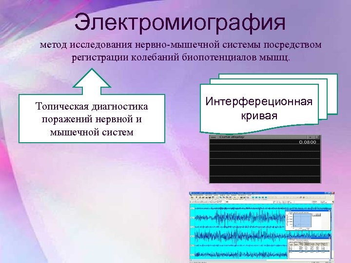 Электромиография метод исследования нервно-мышечной системы посредством регистрации колебаний биопотенциалов мышц. Топическая диагностика поражений нервной