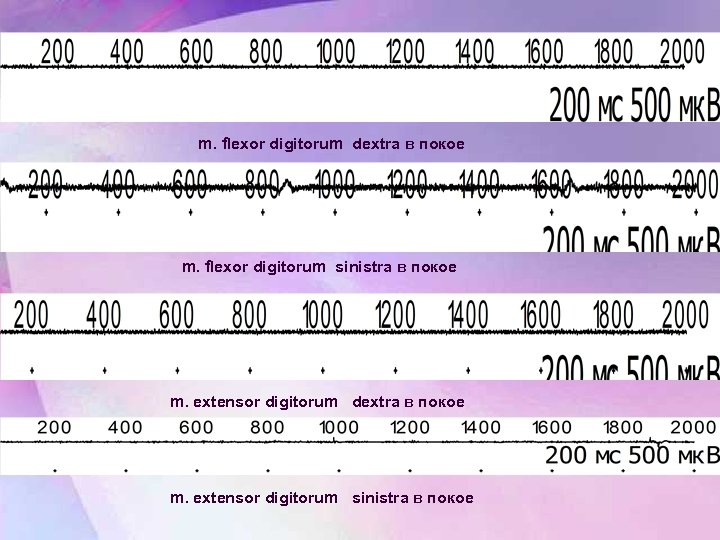 m. flexor digitorum dextra в покое m. flexor digitorum sinistra в покое m. extensor
