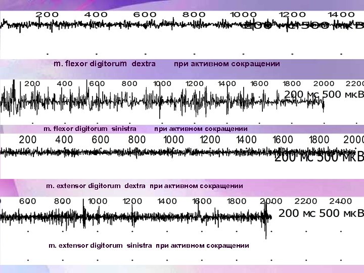 m. flexor digitorum dextra m. flexor digitorum sinistra при активном сокращении m. extensor digitorum