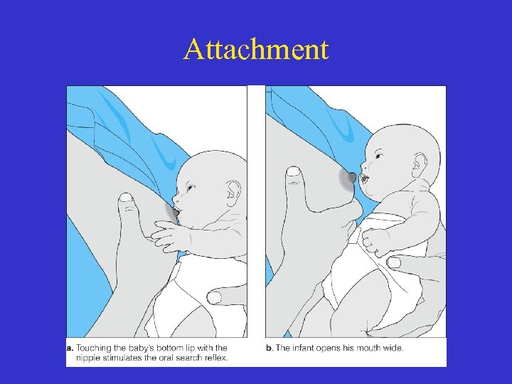 Attachment 