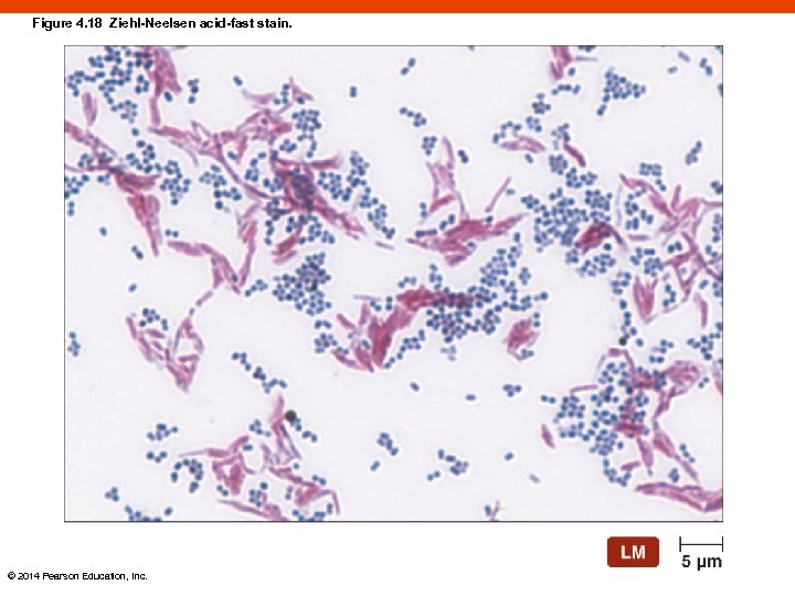 Figure 4. 18 Ziehl-Neelsen acid-fast stain. © 2014 Pearson Education, Inc. 