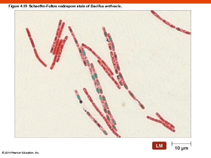 Figure 4. 19 Schaeffer-Fulton endospore stain of Bacillus anthracis. © 2014 Pearson Education, Inc.