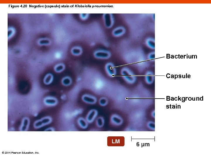 Figure 4. 20 Negative (capsule) stain of Klebsiella pneumoniae. Bacterium Capsule Background stain ©