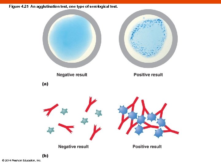 Figure 4. 25 An agglutination test, one type of serological test. © 2014 Pearson