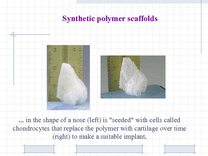 Synthetic polymer scaffolds . . . in the shape of a nose (left) is