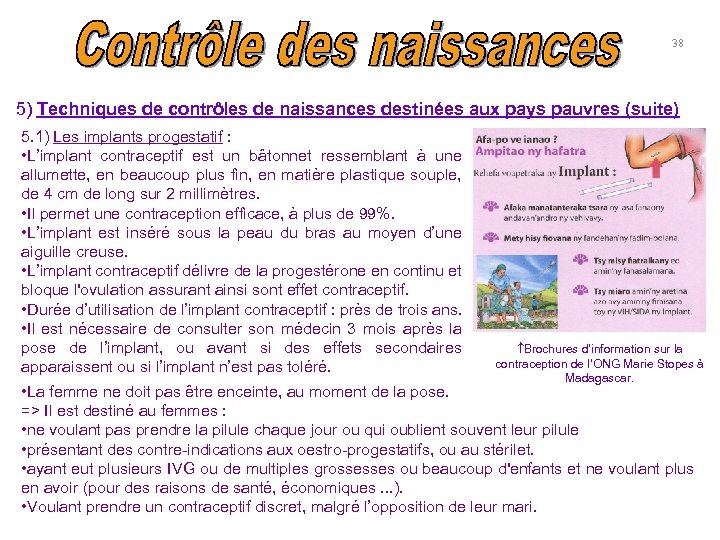 38 5) Techniques de contrôles de naissances destinées aux pays pauvres (suite) 5. 1)