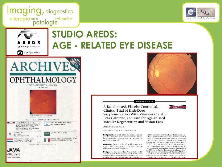 STUDIO AREDS: AGE - RELATED EYE DISEASE 