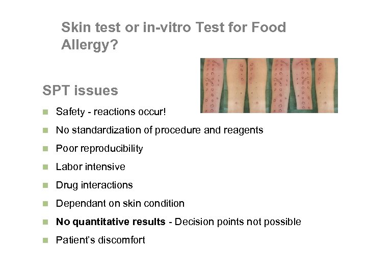 Skin test or in-vitro Test for Food Allergy? Ig. E SPT issues n Safety