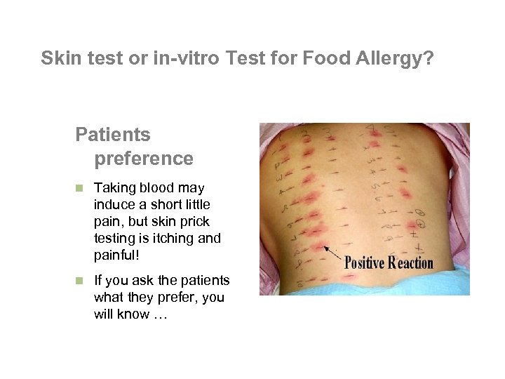 Skin test or in-vitro Test for Food Allergy? Patients preference n Taking blood may