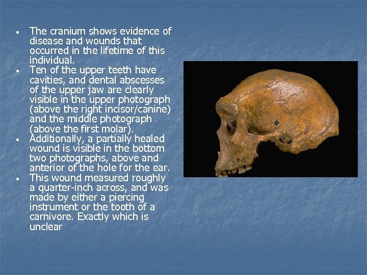  • • The cranium shows evidence of disease and wounds that occurred in