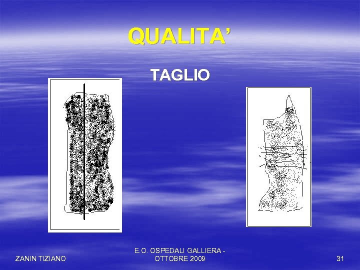 QUALITA’ TAGLIO ZANIN TIZIANO E. O. OSPEDALI GALLIERA OTTOBRE 2009 31 