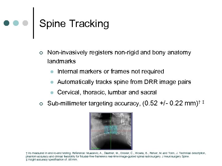 Spine Tracking ¢ Non-invasively registers non-rigid and bony anatomy landmarks l l Automatically tracks
