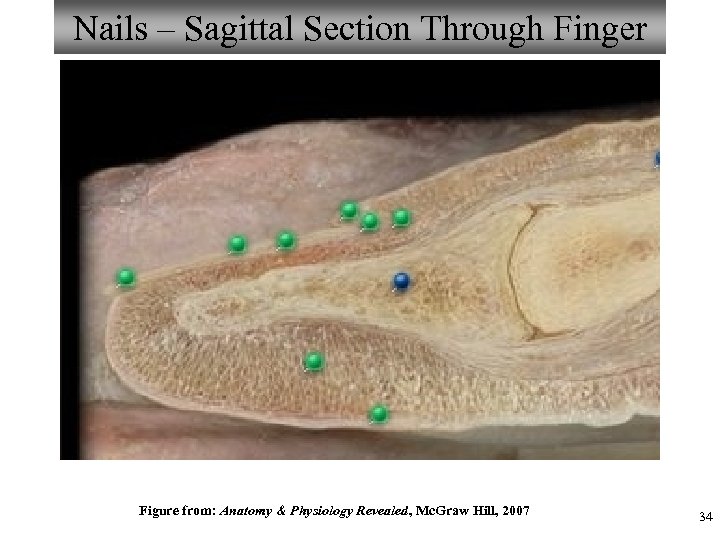 Nails – Sagittal Section Through Finger Figure from: Anatomy & Physiology Revealed, Mc. Graw