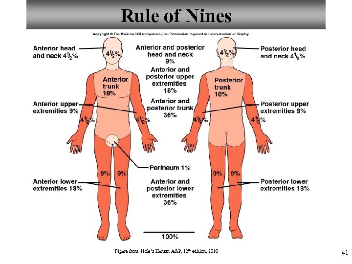 Rule of Nines Figure from: Hole’s Human A&P, 12 th edition, 2010 41 
