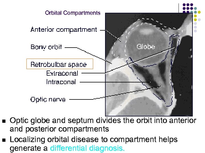 Orbital Compartments n n Optic globe and septum divides the orbit into anterior and