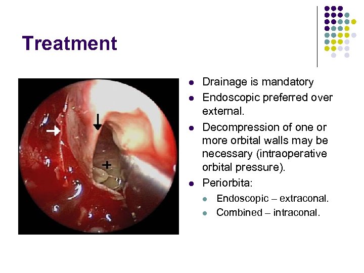 Treatment l l Drainage is mandatory Endoscopic preferred over external. Decompression of one or