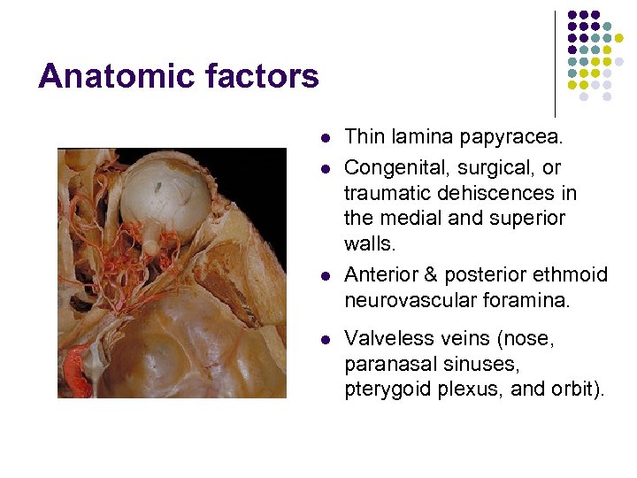 Anatomic factors l l Thin lamina papyracea. Congenital, surgical, or traumatic dehiscences in the