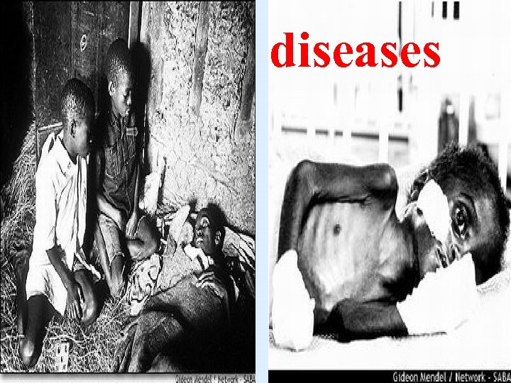diseases 