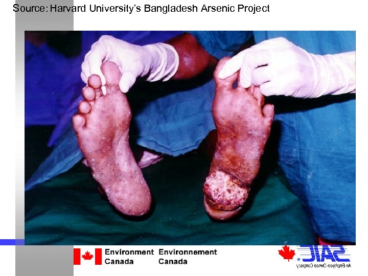 Source: Harvard University’s Bangladesh Arsenic Project Focus of this Study: Arsenic in Water Arsenic