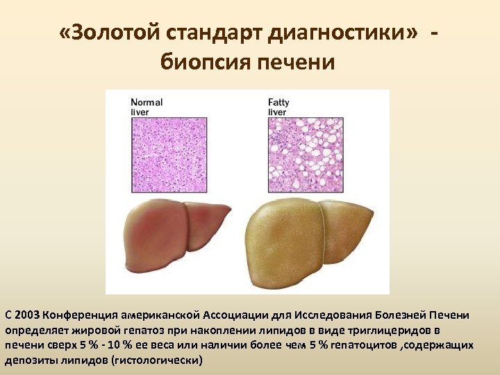 Картинки биопсия печени