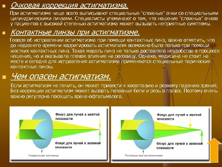 Коррекция астигматизма. Астигматизм схема линзы. Способы коррекции астигматизма. Коррекция астигматизма линзами.