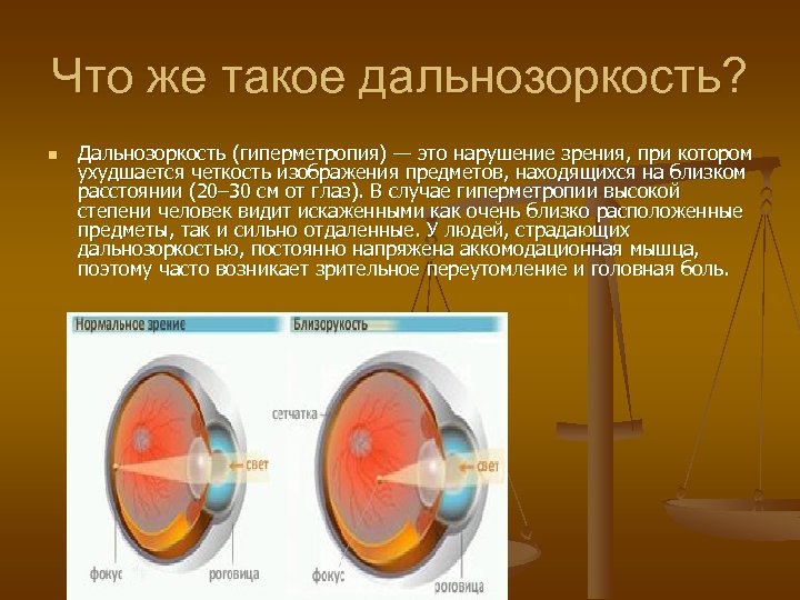 Что же такое дальнозоркость? n Дальнозоркость (гиперметропия) — это нарушение зрения, при котором ухудшается