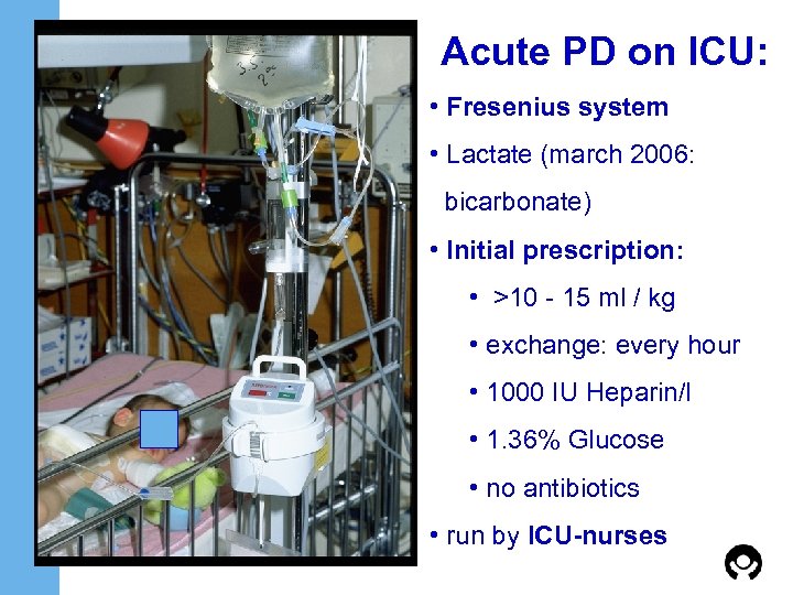 Acute PD on ICU: • Fresenius system • Lactate (march 2006: bicarbonate) • Initial