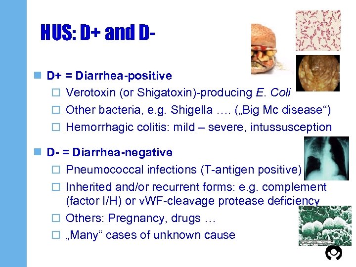 HUS: D+ and Dn D+ = Diarrhea-positive o Verotoxin (or Shigatoxin)-producing E. Coli o