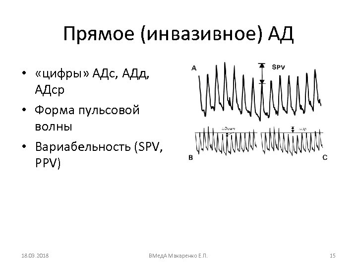 Прямое (инвазивное) АД • «цифры» АДс, АДд, АДср • Форма пульсовой волны • Вариабельность