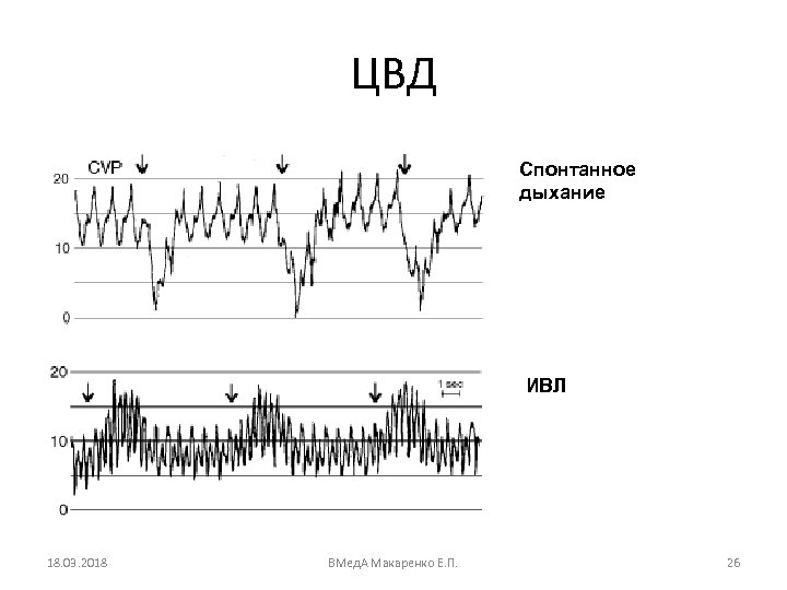 ЦВД Спонтанное дыхание ИВЛ 18. 03. 2018 ВМед. А Макаренко Е. П. 26 